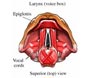 about laryngitis