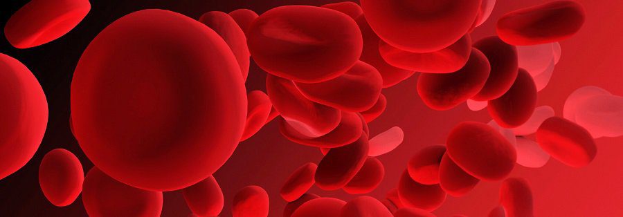 anemia