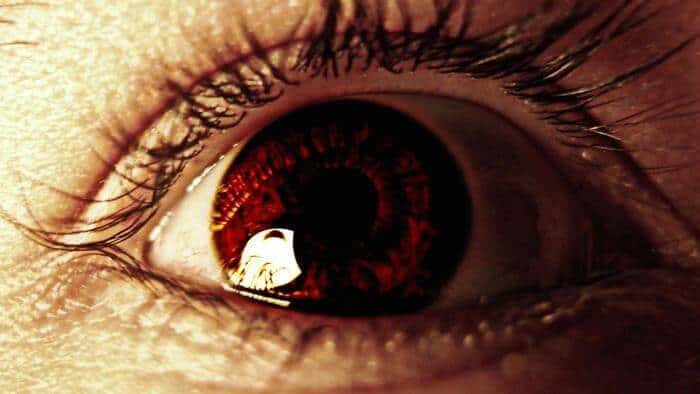 causes eye floaters after cataract surgery af2d23bf2416493b