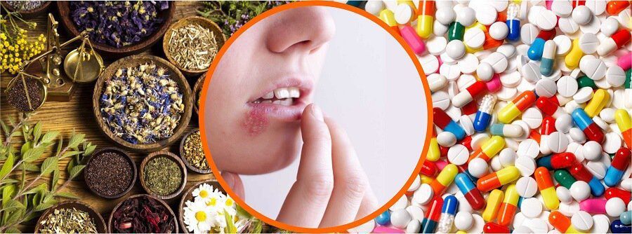 herpes conventional and herbal treatment 1