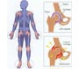 about arthritis1