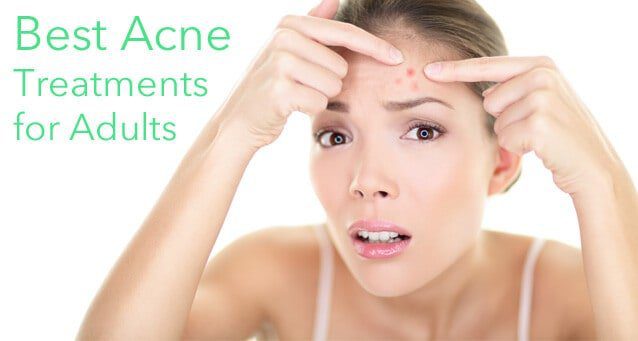 adult acne treatment