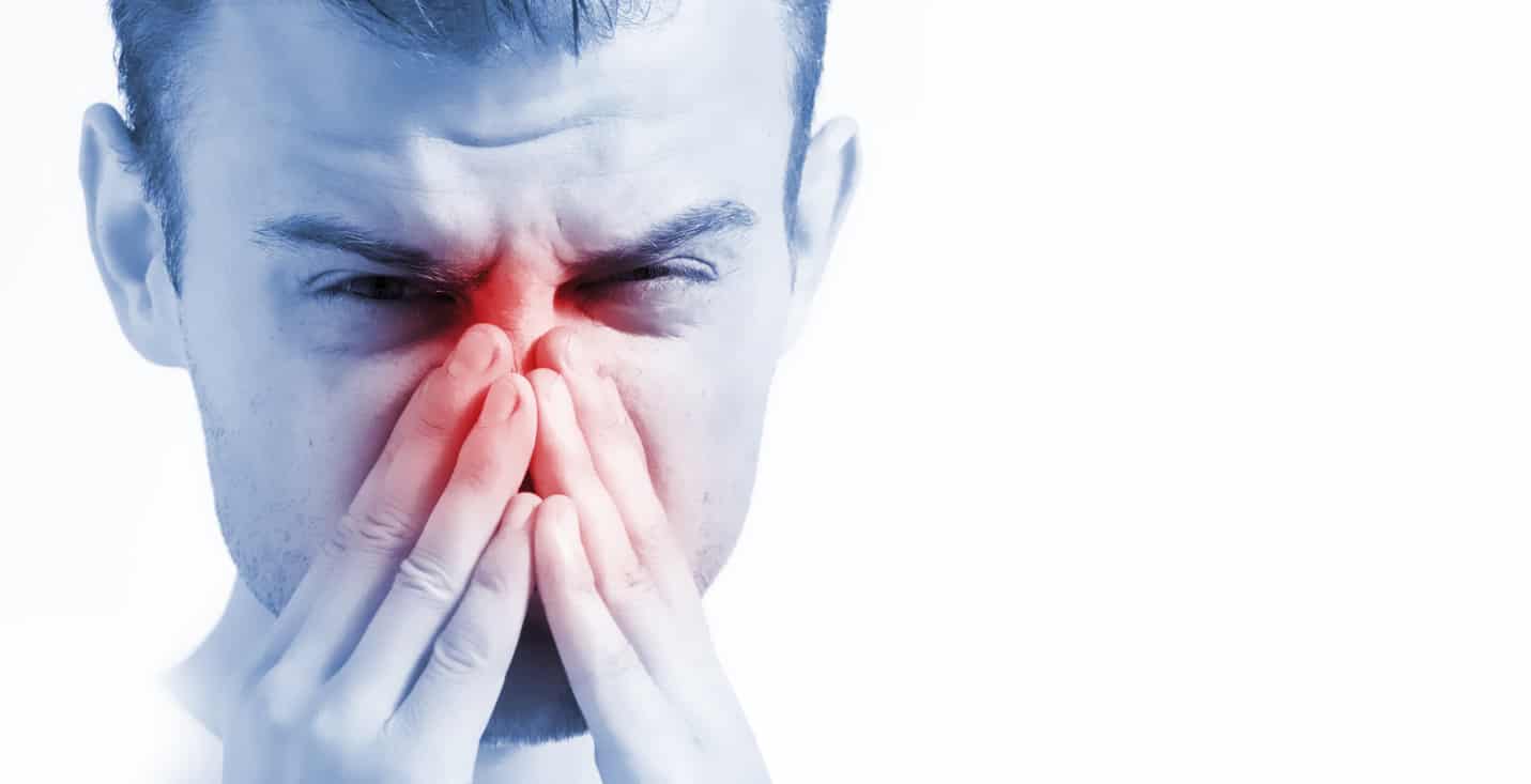 allergic rhinitis