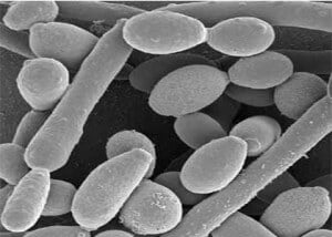 Candida