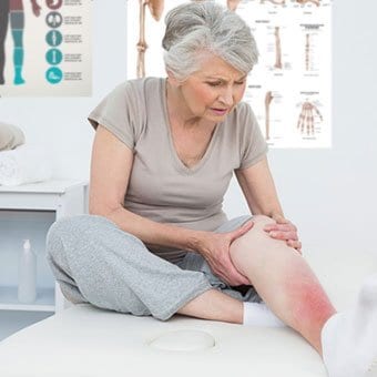 cellulitis s1 facts
