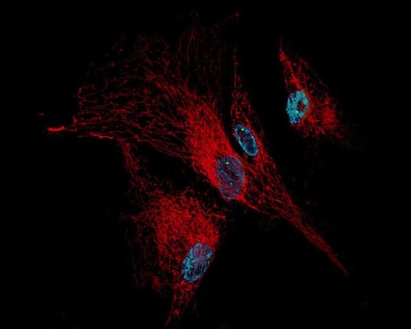cms aging cells
