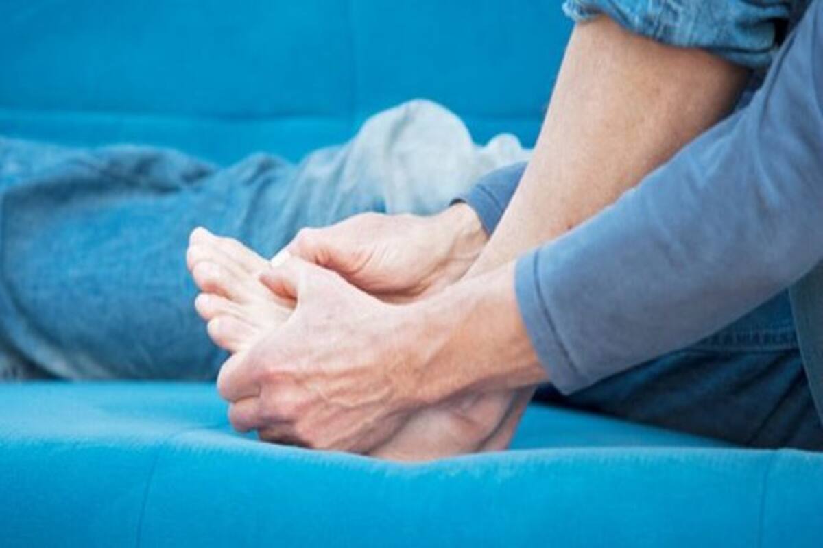 Edema symptoms causes