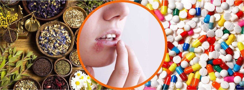 herpes conventional and herbal treatment 1