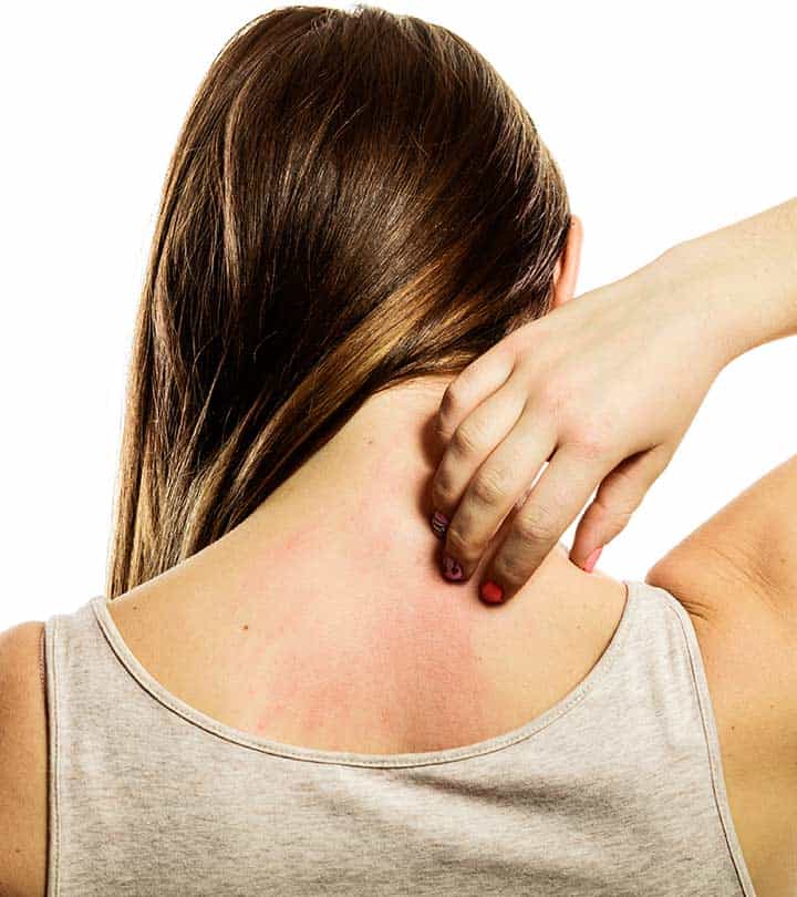How To Get Rid Of A Skin Rash