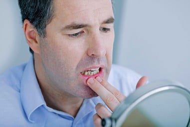 mouth sores ulcers