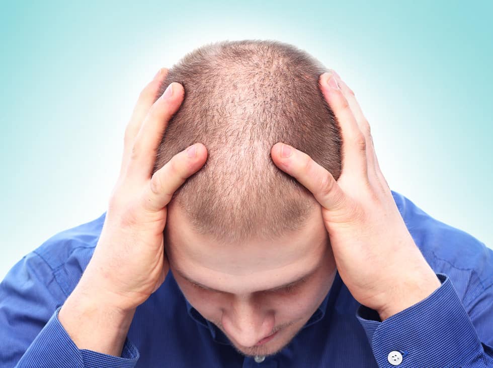 prp hair loss treatment 980x731