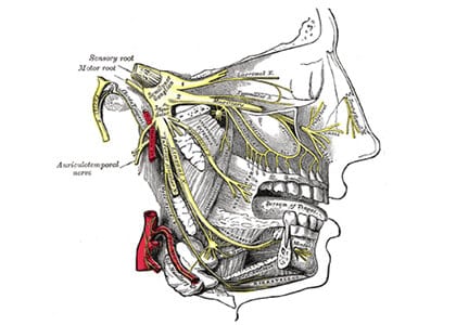 Trigeminal neuralgia