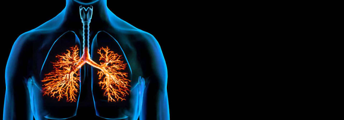 Bronchitis