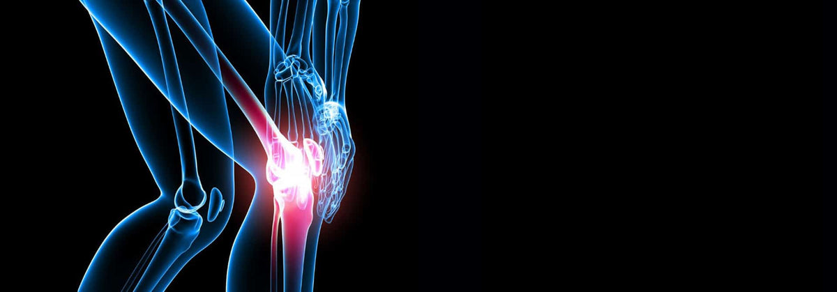 Bursitis