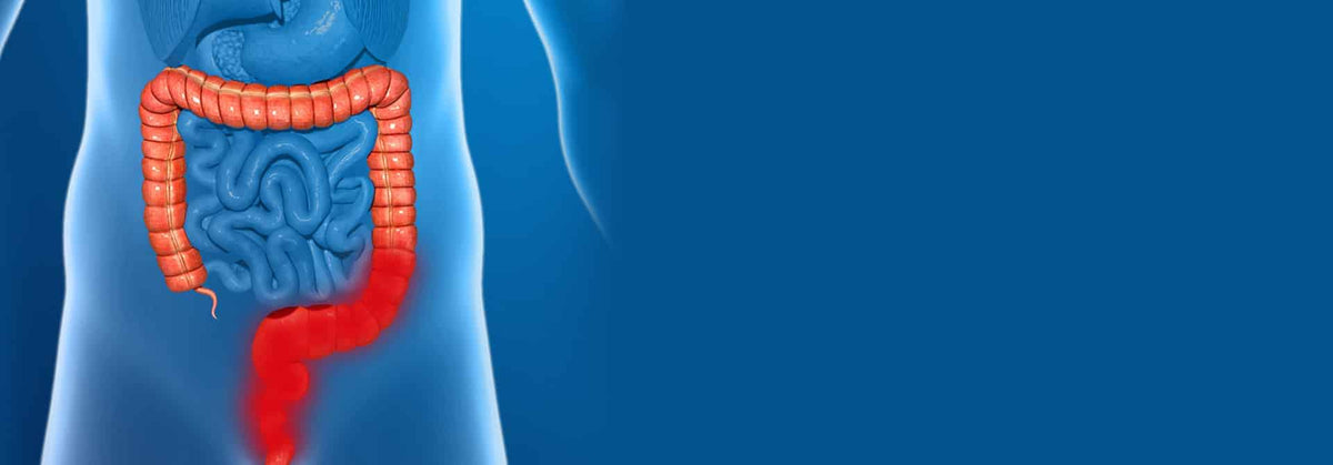 Colitis