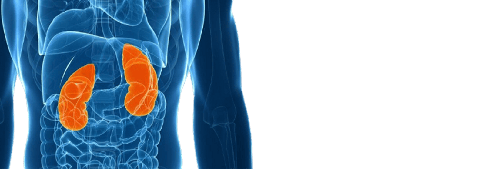 Kidney Stone